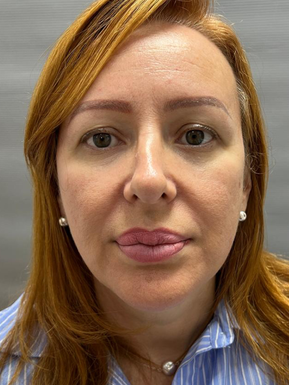 Antes - resultado cicatrizado